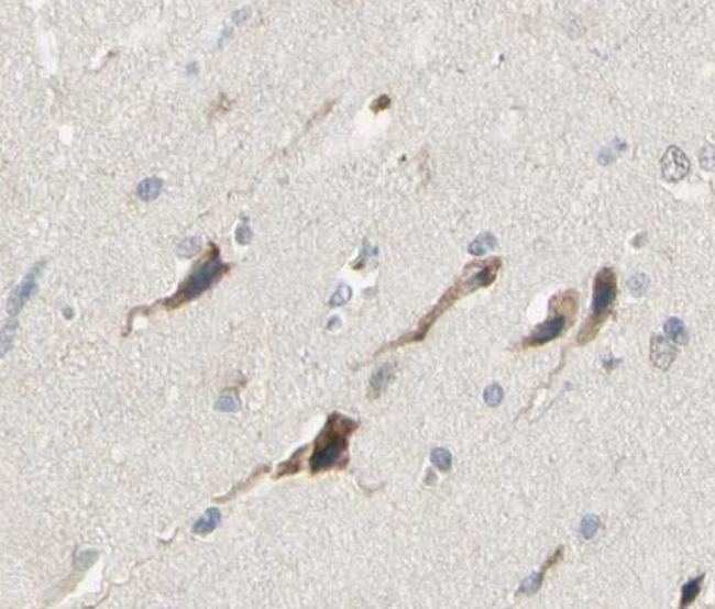 IL5 Antibody - 1/100 staining human brain tissue by IHC-P. The sample was formaldehyde fixed and a heat mediated antigen retrieval step in citrate buffer was performed. The sample was then blocked and incubated with the antibody for 1.5 hours at 22°C. An HRP conjugated goat anti-rabbit antibody was used as the secondary antibody.