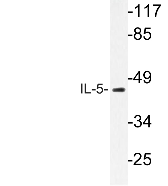 IL5 Antibody - Western blot of IL-5 (S92) pAb in extracts from HT-29 cells.