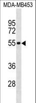 IL5RA / CD125 Antibody - IL5RA Antibody western blot of MDA-MB453 cell line lysates (35 ug/lane). The IL5RA antibody detected the IL5RA protein (arrow).