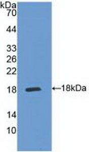 IL5RA / CD125 Antibody