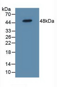 IL5RA / CD125 Antibody