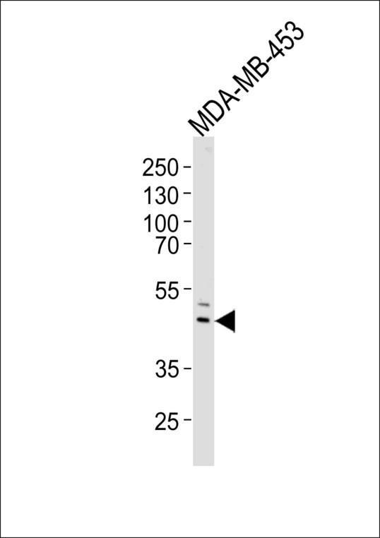IL5RA / CD125 Antibody - Western blot of lysate from MDA-MB-453 cell line, using IL5RA Antibody. Antibody was diluted at 1:1000 at each lane. A goat anti-rabbit IgG H&L (HRP) at 1:5000 dilution was used as the secondary antibody. Lysate at 35ug per lane.