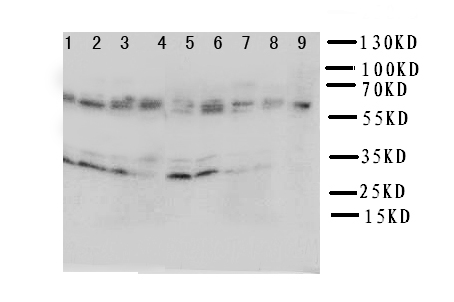 IL5RA / CD125 Antibody - WB of IL5RA / CD125 antibody. Lane 1: A549 Cell Lysate. Lane 2: SMMC Cell Lysate. Lane 3: U87 Cell Lysate . Lane 4: 293T Cell Lysate. Lane 5: PANC Cell Lysate. Lane 6: HELA Cell Lysate. Lane 7: JURKAT Cell Lysate. Lane 8: RAJI Cell Lysate. Lane 9: CEM Cell Lysate.