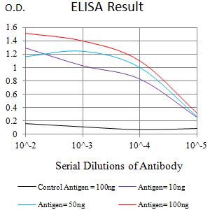IL5RA / CD125 Antibody - Black line: Control Antigen (100 ng);Purple line: Antigen (10ng); Blue line: Antigen (50 ng); Red line:Antigen (100 ng)