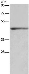 IL5RA / CD125 Antibody - Western blot analysis of Mouse heart tissue, using IL5RA Polyclonal Antibody at dilution of 1:650.