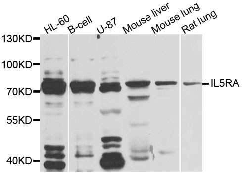 IL5RA / CD125 Antibody - Western blot analysis of extracts of various cells.
