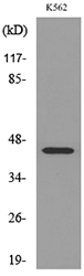 IL5RA / CD125 Antibody - Western blot analysis of lysate from K562 cells, using IL5RA Antibody.