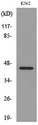 IL5RA / CD125 Antibody - Western blot analysis of lysate from K562 cells, using IL5RA Antibody.