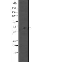 IL5RA / CD125 Antibody - Western blot analysis of IL5RA expression in mouse heart tissue lysates. The lane on the left is treated with the antigen-specific peptide.