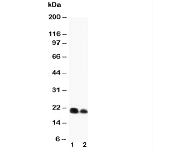 IL6 / Interleukin 6 Antibody - Western blot testing of IL-6 antibody and recombinant protein (1) 10ng, (2) 5ng
