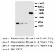 IL6 / Interleukin 6 Antibody -  This image was taken for the unconjugated form of this product. Other forms have not been tested.