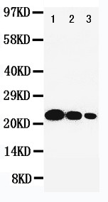 IL6 / Interleukin 6 Antibody - WB of IL6 antibody. All lanes: Anti-IL6 at 0.5ug/ml. Lane 1: Recombinant Human IL-6 Protein 10ng. Lane 2: Recombinant Human IL-6 Protein 5ng. Lane 3: Recombinant Human IL-6 Protein 2.5ng. Predicted bind size: 22KD. Observed bind size: 22KD.