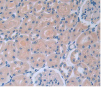 IL6 / Interleukin 6 Antibody - DAB staining on IHC-P Samples: Rat Kidney Tissue