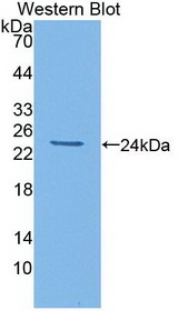 IL6 / Interleukin 6 Antibody - Western Blot; Sample: Recombinant protein.