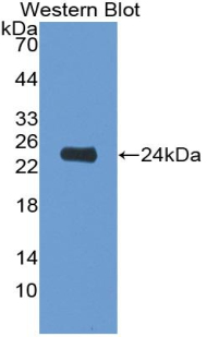 IL6 / Interleukin 6 Antibody - Western blot of recombinant IL6.