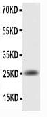 IL6 / Interleukin 6 Antibody - WB of IL6 antibody. All lanes: Anti-IL6 at 0.5ug/ml. WB: Recombinant Rat IL6 Protein 0.5ng. Predicted bind size: 25KD. Observed bind size: 25KD.