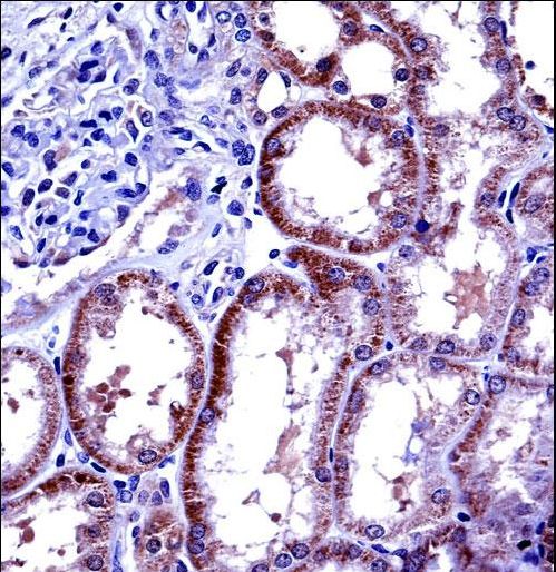 IL6 / Interleukin 6 Antibody - IL6 Antibody immunohistochemistry of formalin-fixed and paraffin-embedded human kidney tissue followed by peroxidase-conjugated secondary antibody and DAB staining.