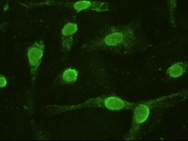 Anti-IL6 / Interleukin 6 Antibody | Mouse anti-Human Monoclonal | LSBio