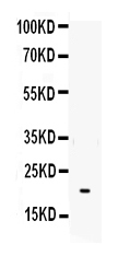 IL6 / Interleukin 6 Antibody - Western blot - Anti-IL-6 Antibody