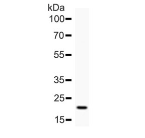 IL6 / Interleukin 6 Antibody - Western blot testing of human recombinant protein with IL6 antibody.