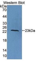 IL6 / Interleukin 6 Antibody - Western blot of IL6 / Interleukin 6 antibody.