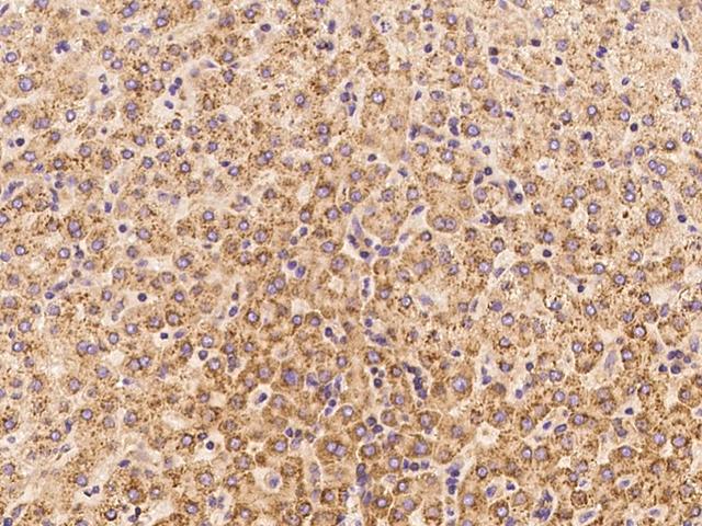 IL6 / Interleukin 6 Antibody - Immunochemical staining of human IL6 in human liver with mouse monoclonal antibody at 1:60 dilution, formalin-fixed paraffin embedded sections.