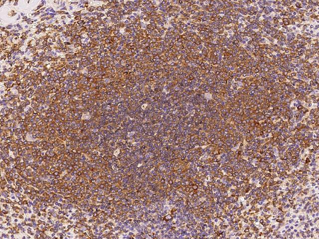 IL6 / Interleukin 6 Antibody - Immunochemical staining of human IL6 in human spleen with mouse monoclonal antibody at 1:60 dilution, formalin-fixed paraffin embedded sections.