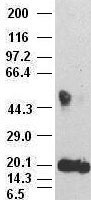 IL6 / Interleukin 6 Antibody - IL-6 antibody (3G9) at 1:500000 + recombinant human IL-6.