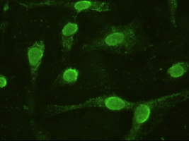 IL6 / Interleukin 6 Antibody - Anti-IL-6 mouse monoclonal antibody  immunofluorescent staining of HeLa cells transiently transfected by pCMV6-ENTRY IL-6.