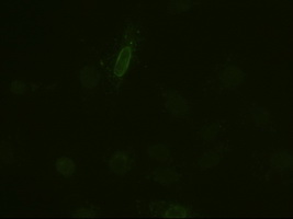 IL6 / Interleukin 6 Antibody - Anti-IL-6 mouse monoclonal antibody immunofluorescent staining of HELA cells transiently transfected by pCMV6-ENTRY IL-6.