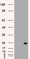 IL6 / Interleukin 6 Antibody - IL-6 antibody (3H6) at 1:2000 + recombinant human IL-6.