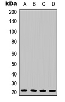 IL6 / Interleukin 6 Antibody - Western blot analysis of IL-6 expression in A549 (A); HepG2 (B); mouse brain (C); mouse heart (D) whole cell lysates.