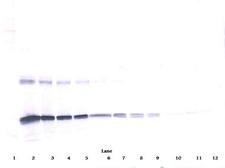 IL6 / Interleukin 6 Antibody - Anti-Human IL-6 Western Blot Reduced