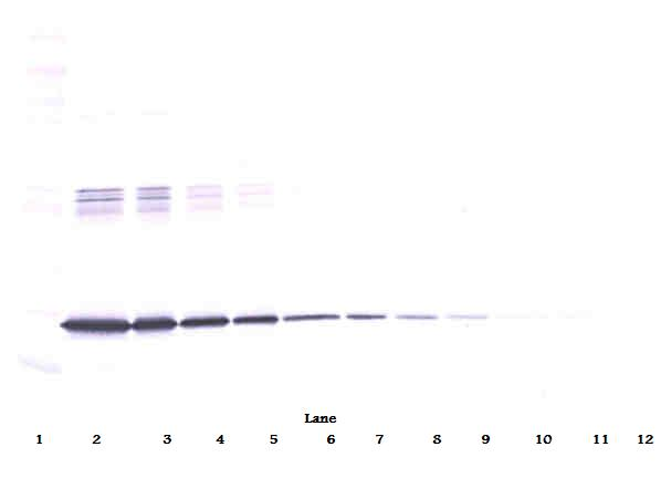 IL6 / Interleukin 6 Antibody - Anti-Human IL-6 Western Blot Unreduced