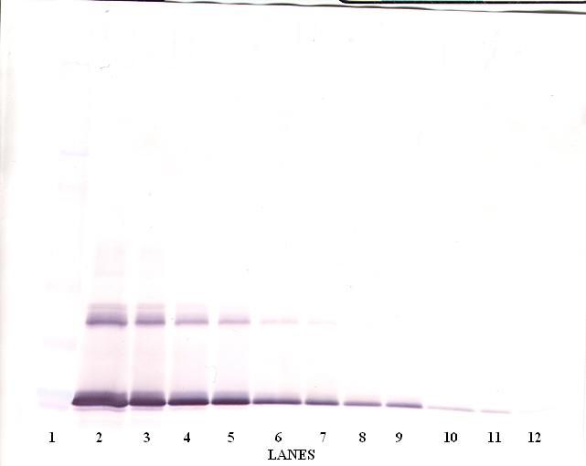 IL6 / Interleukin 6 Antibody - Western Blot (non-reducing) of IL-6 antibody. This image was taken for the unconjugated form of this product. Other forms have not been tested.