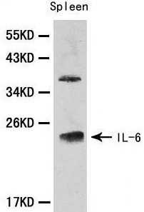 IL6 / Interleukin 6 Antibody - Western blot of IL-6 pAb in extracts from mouse spleen tissue.