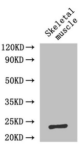 IL6 / Interleukin 6 Antibody - Western Blot Positive WB detected in: Mouse skeletal muscle All lanes: IL6 antibody at 2µg/ml Secondary Goat polyclonal to rabbit IgG at 1/50000 dilution Predicted band size: 23 kDa Observed band size: 23 kDa
