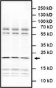IL6 / Interleukin 6 Antibody - Western blot analysis of IL-6 was performed by loading 20µg of LPS-treated THP-1 whole cell lysates in non-reducing sample buffer and 8ul PageRuler Plus Prestained Protein Ladder per well onto a 4-20% Tris-Glycine polyacrylamide gel. Proteins were transferred to a nitrocellulose membrane using the G2 Fast Blotter and blocked with 5% Milk/TBST for at least 1 hour at room temperature. IL-6 was detected using a IL-6 rabbit polyclonal antibody at a dilution of 1:1000 in blocking buffer overnight at 4°C on a rocking platform, followed by a HRP conjugated secondary antibody at a dilution of 1:5000 for at least 1 hour at room temperature. Chemiluminescent detection was performed using SuperSignal West Dura Extended Duration Substrate and the myECL Imager.