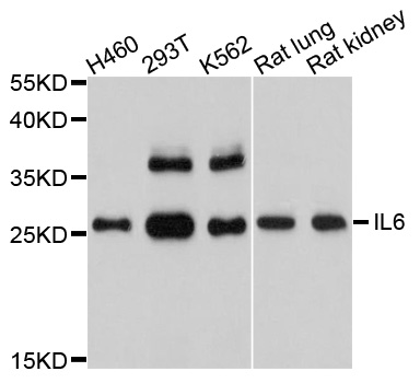IL6 / Interleukin 6 Antibody - Western blot analysis of extracts of various cell lines.