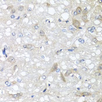 IL6 / Interleukin 6 Antibody - Immunohistochemistry of paraffin-embedded rat brain using IL6 antibody at dilution of 1:100 (40x lens).