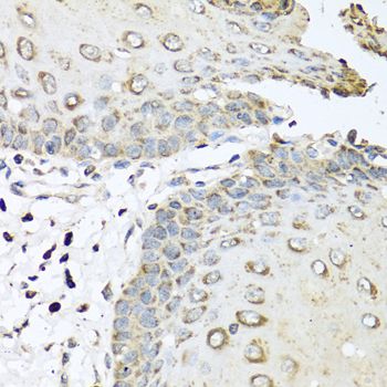 IL6 / Interleukin 6 Antibody - Immunohistochemistry of paraffin-embedded human esophagus using IL6 antibody at dilution of 1:100 (40x lens).