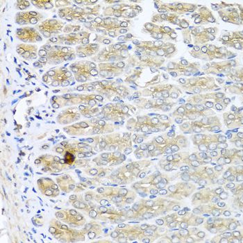 IL6 / Interleukin 6 Antibody - Immunohistochemistry of paraffin-embedded mouse stomach using IL6 antibody at dilution of 1:100 (40x lens).