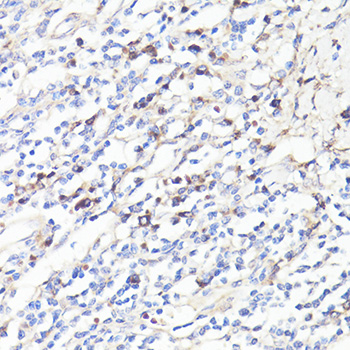 IL6 / Interleukin 6 Antibody - Immunohistochemistry of paraffin-embedded human tonsil using IL6 antibody at dilution of 1:100 (40x lens).