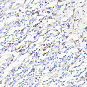 IL6 / Interleukin 6 Antibody - Immunohistochemistry of paraffin-embedded human tonsil using IL6 antibody at dilution of 1:100 (40x lens).