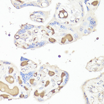 IL6 / Interleukin 6 Antibody - Immunohistochemistry of paraffin-embedded human placenta using IL6 antibody at dilution of 1:100 (40x lens).