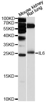 IL6 / Interleukin 6 Antibody - Western blot analysis of extracts of various cell lines, using IL6 antibody at 1:3000 dilution. The secondary antibody used was an HRP Goat Anti-Rabbit IgG (H+L) at 1:10000 dilution. Lysates were loaded 25ug per lane and 3% nonfat dry milk in TBST was used for blocking. An ECL Kit was used for detection and the exposure time was 90s.