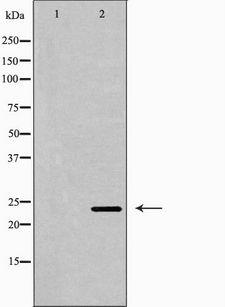 IL6 / Interleukin 6 Antibody - Western blot analysis of extracts of mouse spleen tissue using IL-6 antibody. The lane on the left is treated with the antigen-specific peptide.