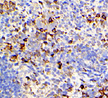 IL6 / Interleukin 6 Antibody - 1:200 staining mouse spleen tissue by IHC-P. The tissue was formaldehyde fixed and a heat mediated antigen retrieval step in citrate buffer was performed. The tissue was then blocked and incubated with the antibody for 1.5 hours at 22°C. An HRP conjugated goat anti-rabbit antibody was used as the secondary.