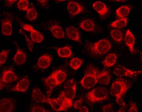 IL6 / Interleukin 6 Antibody - Staining HepG2 cells by IF/ICC. The samples were fixed with PFA and permeabilized in 0.1% Triton X-100, then blocked in 10% serum for 45 min at 25°C. The primary antibody was diluted at 1:200 and incubated with the sample for 1 hour at 37°C. An Alexa Fluor 594 conjugated goat anti-rabbit IgG (H+L) Ab, diluted at 1/600, was used as the secondary antibody.