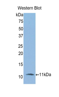IL6R / IL6 Receptor Antibody - Western blot of recombinant IL6R / IL6 Receptor.  This image was taken for the unconjugated form of this product. Other forms have not been tested.